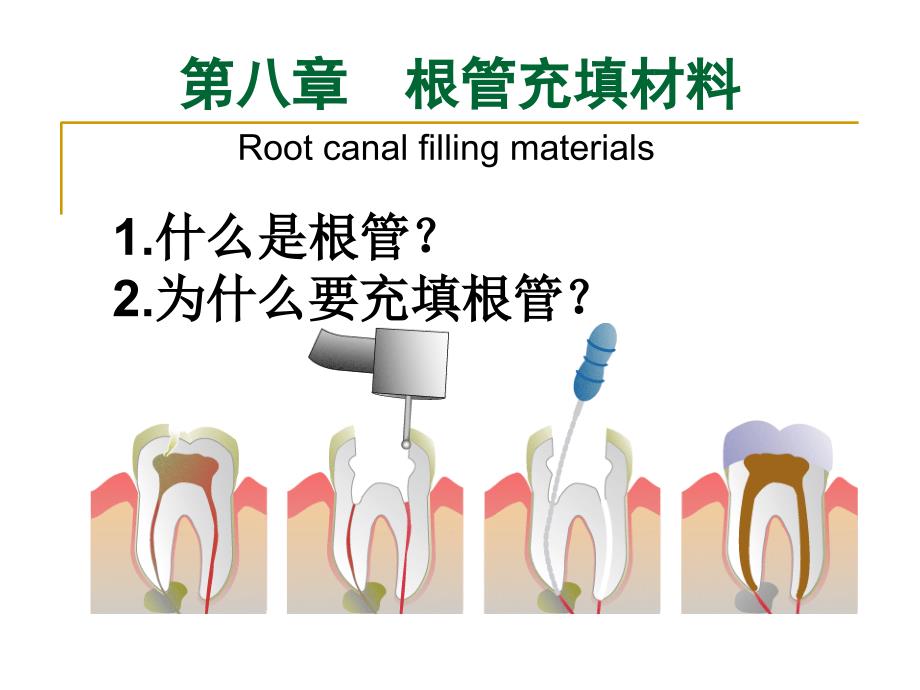 根管充填材料课件_第1页